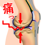 関節痛